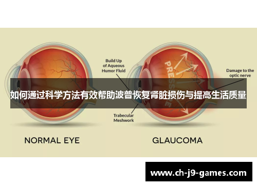 如何通过科学方法有效帮助波普恢复肾脏损伤与提高生活质量